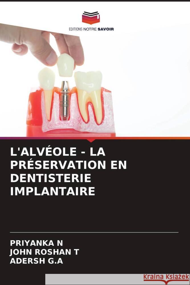L'ALVÉOLE - LA PRÉSERVATION EN DENTISTERIE IMPLANTAIRE N, PRIYANKA, Roshan T, John, G.A, Adersh 9786208230814 Editions Notre Savoir - książka