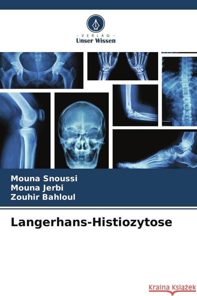 Langerhans-Histiozytose Mouna Snoussi Mouna Jerbi Zouhir Bahloul 9786206974680 Verlag Unser Wissen - książka