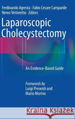 Laparoscopic Cholecystectomy: An Evidence-Based Guide Agresta, Ferdinando 9783319054063 Springer - książka