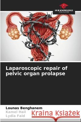 Laparoscopic repair of pelvic organ prolapse Lounas Benghanem Kamel Hail Lydia Faid 9786207711482 Our Knowledge Publishing - książka