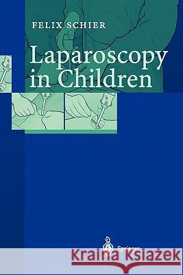Laparoscopy in Children Felix Schier 9783642076947 Springer-Verlag Berlin and Heidelberg GmbH &  - książka