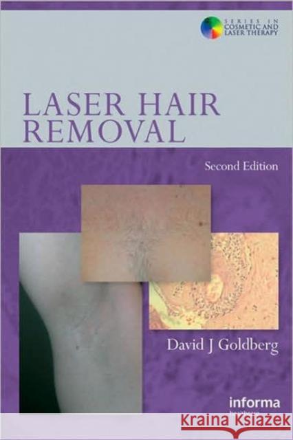 Laser Hair Removal David J. Goldberg 9780415414128 Informa Healthcare - książka