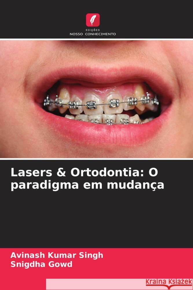 Lasers & Ortodontia: O paradigma em mudança Singh, Avinash Kumar, Gowd, Snigdha 9786204510996 Edições Nosso Conhecimento - książka