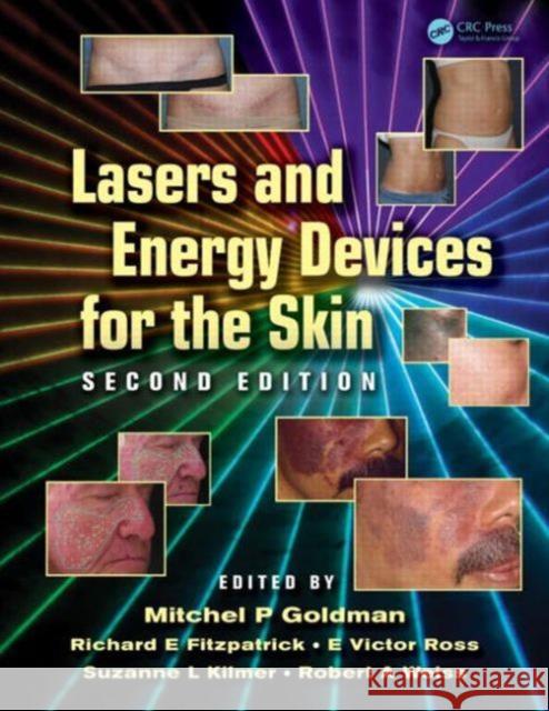 Lasers and Energy Devices for the Skin Mitchel P. Goldman Richard Fitzpatrick Victor Ross 9781841849331 Informa Healthcare - książka