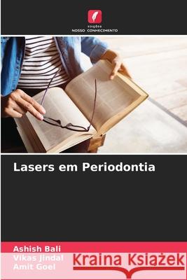 Lasers em Periodontia Ashish Bali Vikas Jindal Amit Goel 9786207521548 Edicoes Nosso Conhecimento - książka