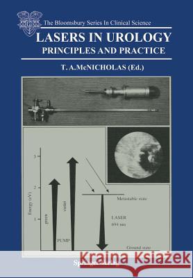 Lasers in Urology: Principles and Practice McNicholas, Thomas A. 9781447117858 Springer - książka