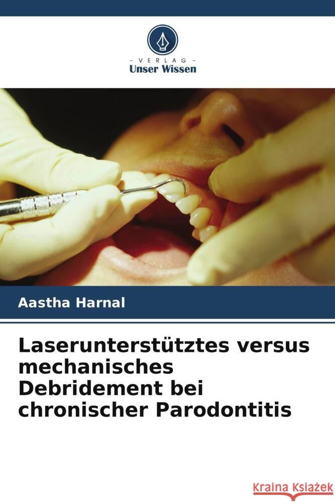 Laserunterstütztes versus mechanisches Debridement bei chronischer Parodontitis Aastha Harnal 9786205375655 Verlag Unser Wissen - książka