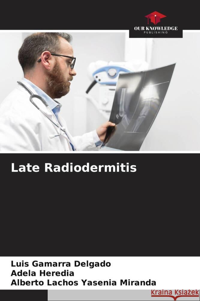 Late Radiodermitis Luis Gamarr Adela Heredia Alberto Lachos Yaseni 9786206859765 Our Knowledge Publishing - książka