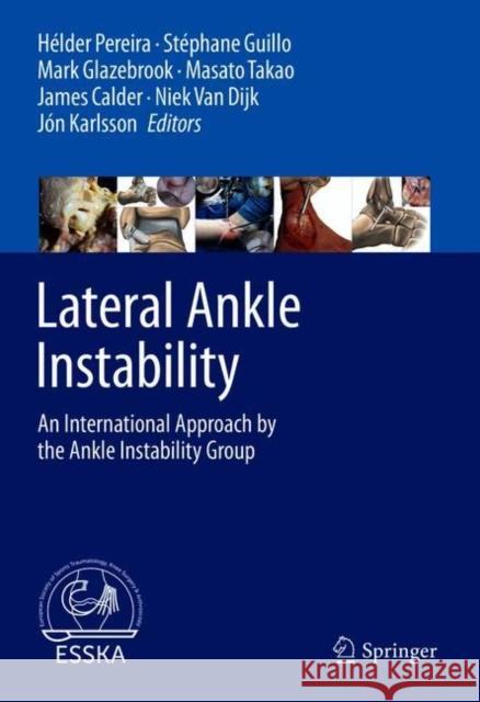 Lateral Ankle Instability: An International Approach by the Ankle Instability Group H Pereira St 9783662627624 Springer - książka