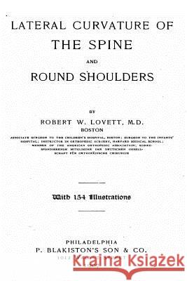 Lateral Curvature of the Spine and Round Shoulders Robert Williamson Lovett 9781535065290 Createspace Independent Publishing Platform - książka