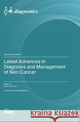 Latest Advances in Diagnosis and Management of Skin Cancer Choon Chiat Oh 9783725842513 Mdpi AG - książka