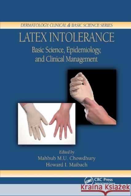 Latex Intolerance: Basic Science, Epidemiology, and Clinical Management Mahbub M. U. Chowdhury 9780367393847 CRC Press - książka