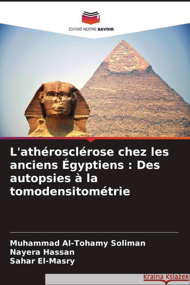 L'athérosclérose chez les anciens Égyptiens : Des autopsies à la tomodensitométrie Al-Tohamy Soliman, Muhammad, Hassan, Nayera, El-Masry, Sahar 9786208202552 Editions Notre Savoir - książka