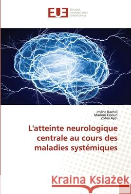 L'atteinte neurologique centrale au cours des maladies systémiques Rachdi, Imene 9786202538732 Editions Universitaires Europeennes - książka