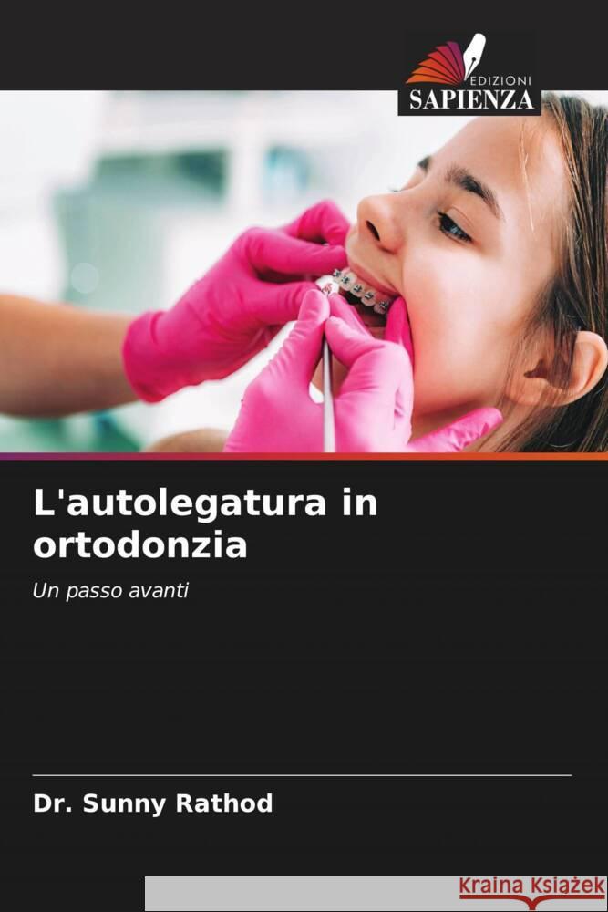 L\'autolegatura in ortodonzia Sunny Rathod 9786205674086 Edizioni Sapienza - książka