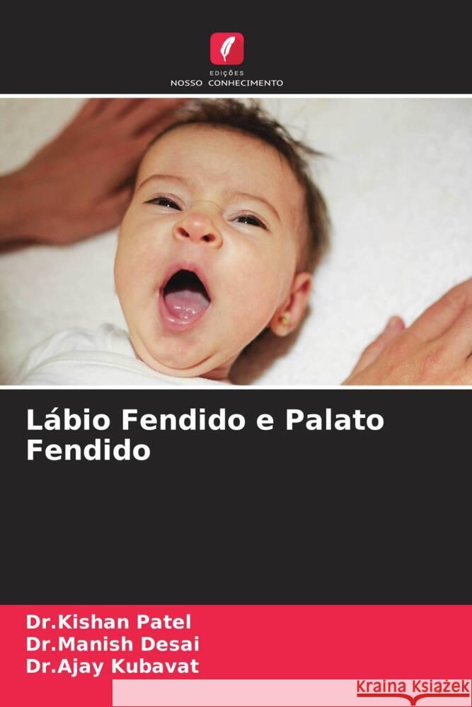 Lábio Fendido e Palato Fendido Patel, Dr.Kishan, Desai, Dr.Manish, Kubavat, Dr.Ajay 9786204707532 Edições Nosso Conhecimento - książka