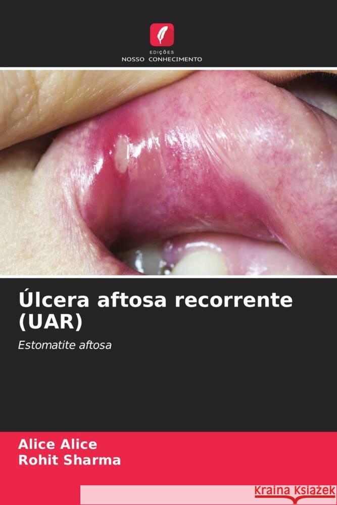 ?lcera aftosa recorrente (UAR) Alice Alice Rohit Sharma 9786207419043 Edicoes Nosso Conhecimento - książka