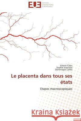 Le Placenta Dans Tous Ses États Collectif 9786131586712 Editions Universitaires Europeennes - książka