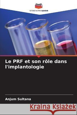 Le PRF et son r?le dans l\'implantologie Anjum Sultana 9786205842836 Editions Notre Savoir - książka