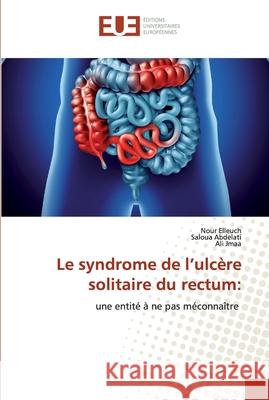 Le syndrome de l'ulcère solitaire du rectum Elleuch, Nour 9786139541621 Éditions universitaires européennes - książka