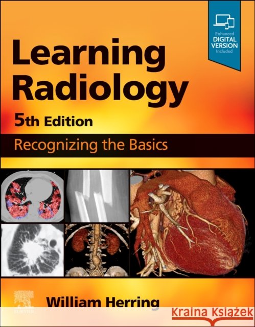 Learning Radiology: Recognizing the Basics William, MD, FACR (Vice Chairman and Residency Program Director, Albert Einstein Medical Center, Philadelphia, PA, USA) 9780323878173 Elsevier - Health Sciences Division - książka