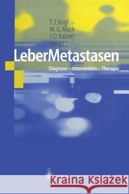 Lebermetastasen: Diagnose -- Intervention -- Therapie Vogl, T. J. 9783642639586 Springer - książka