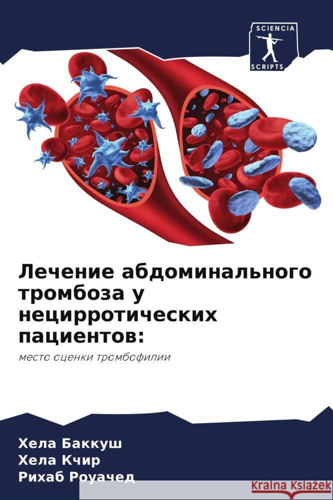Lechenie abdominal'nogo tromboza u necirroticheskih pacientow: Bakkush, Hela, Kchir, Hela, Rouached, Rihab 9786205147191 Sciencia Scripts - książka