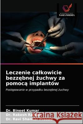 Leczenie calkowicie bezzębnej żuchwy za pomocą implantów Kumar, Bineet 9786203662412 Wydawnictwo Nasza Wiedza - książka