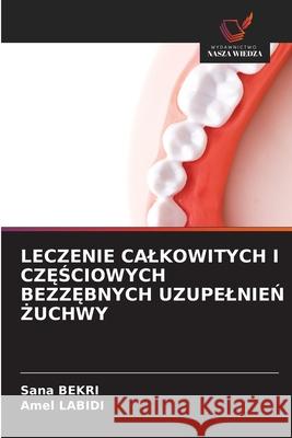 LECZENIE CALKOWITYCH I CZ SCIOWYCH BEZZ BNYCH UZUPELNIEN  UCHWY Bekri, Sana, Labidi, Amel 9786208850265 Wydawnictwo Nasza Wiedza - książka