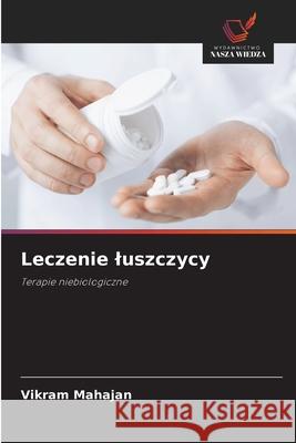 Leczenie luszczycy Mahajan, Vikram 9786208862671 Wydawnictwo Nasza Wiedza - książka