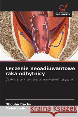Leczenie neoadiuwantowe raka odbytnicy Bacha, Dhouha, Jedidi, Malek 9786208468439 Wydawnictwo Nasza Wiedza - książka