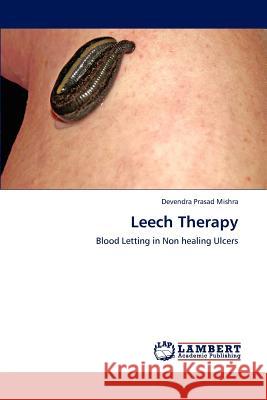 Leech Therapy  9783659294259 LAP Lambert Academic Publishing - książka