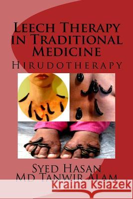 Leech Therapy in Traditional Medicine: Hirudotherapy Syed I. Hasan MD Tanwir Alam 9781517784430 Createspace - książka