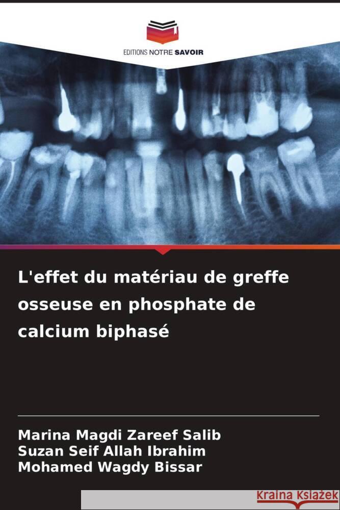 L'effet du matériau de greffe osseuse en phosphate de calcium biphasé Magdi Zareef Salib, Marina, Seif Allah Ibrahim, Suzan, Wagdy Bissar, Mohamed 9786205440629 Editions Notre Savoir - książka