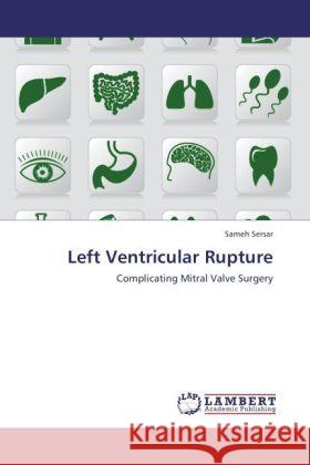 Left Ventricular Rupture Sersar, Sameh 9783847321286 LAP Lambert Academic Publishing - książka