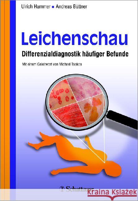 Leichenschau : Differenzialdiagnostik häufiger Befunde Hammer, Ulrich; Büttner, Andreas 9783794529643 Schattauer - książka