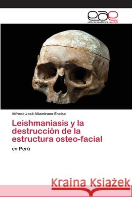 Leishmaniasis y la destrucción de la estructura osteo-facial Altamirano Enciso, Alfredo José 9786202255097 Editorial Académica Española - książka