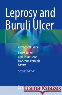 Leprosy and Buruli Ulcer  9783030897062 Springer International Publishing - książka