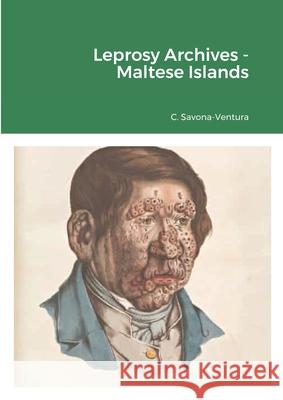 Leprosy Archives - Maltese Islands Charles Savona-Ventura 9781678096052 Lulu.com - książka