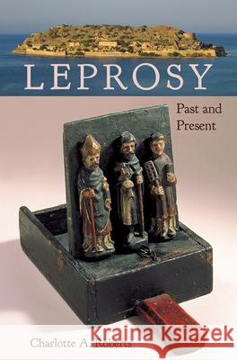 Leprosy: Past and Present Charlotte A. Roberts 9781683401841 University of Florida Press - książka