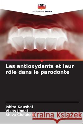 Les antioxydants et leur rôle dans le parodonte Kaushal, Ishita, Jindal, Vikas, Chauhan, Shiva 9786209293634 Editions Notre Savoir - książka