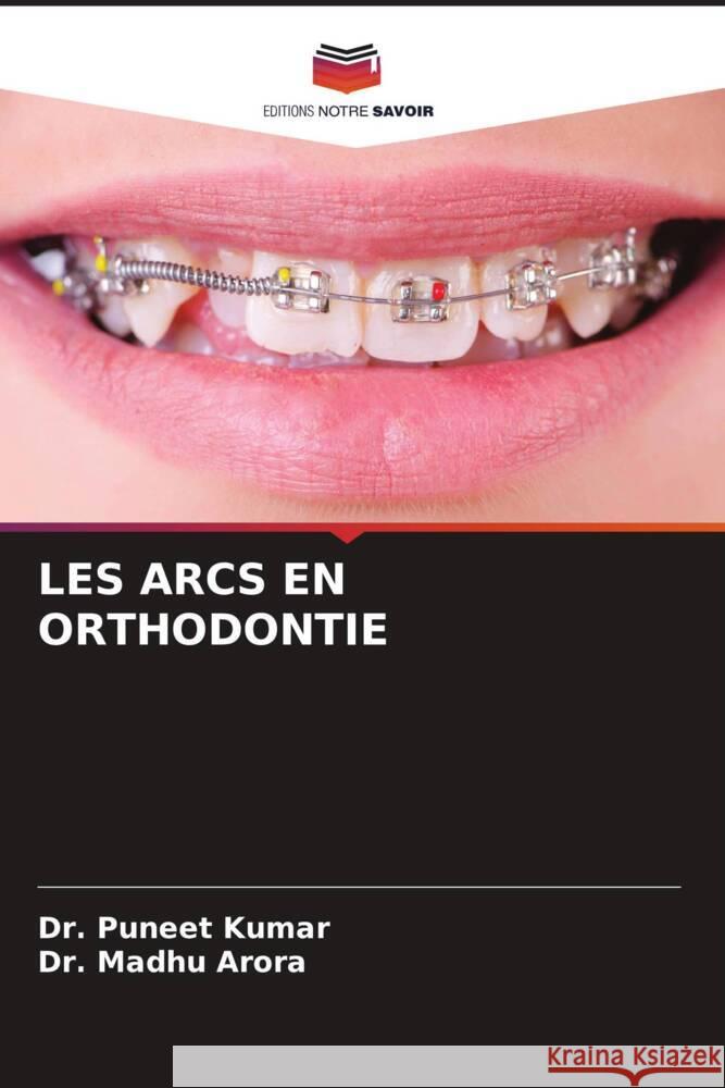 LES ARCS EN ORTHODONTIE Kumar, Dr. Puneet, Arora, Dr. Madhu 9786208248093 Editions Notre Savoir - książka