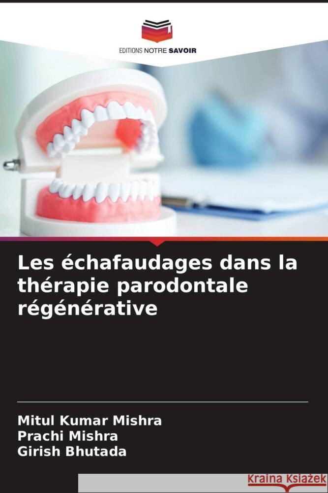 Les échafaudages dans la thérapie parodontale régénérative Mishra, Mitul Kumar, Mishra, Prachi, Bhutada, Girish 9786206925620 Editions Notre Savoir - książka