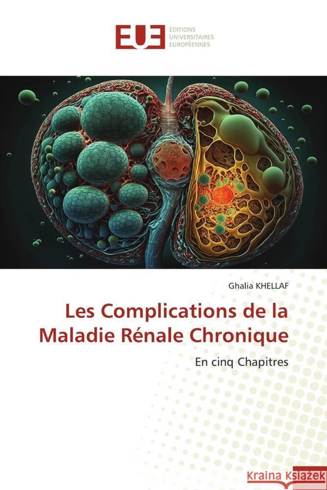 Les Complications de la Maladie R?nale Chronique Ghalia Khellaf 9786206702030 Editions Universitaires Europeennes - książka