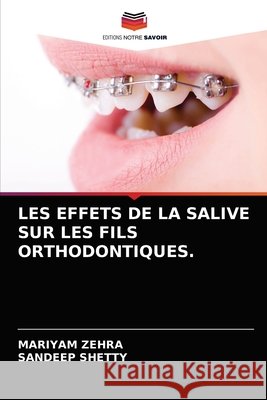 Les Effets de la Salive Sur Les Fils Orthodontiques. Mariyam Zehra, Sandeep Shetty 9786203310528 Editions Notre Savoir - książka