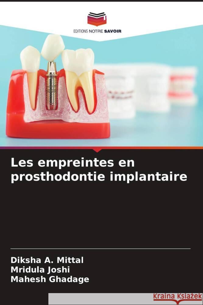 Les empreintes en prosthodontie implantaire A. Mittal, Diksha, Joshi, Mridula, Ghadage, Mahesh 9786205022696 Editions Notre Savoir - książka
