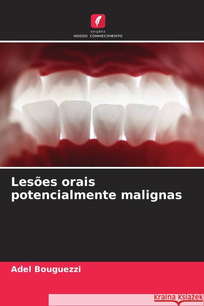 Les?es orais potencialmente malignas Adel Bouguezzi 9786208580278 Edicoes Nosso Conhecimento - książka