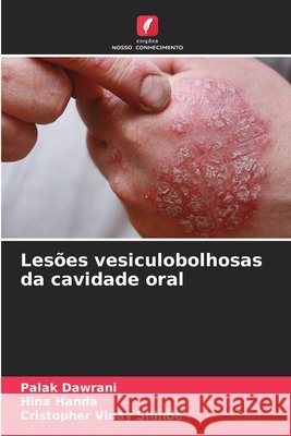 Les?es vesiculobolhosas da cavidade oral Palak Dawrani Hina Handa Cristopher Vinay Shinde 9786208442699 Edicoes Nosso Conhecimento - książka