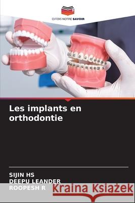 Les implants en orthodontie HS, SIJIN, LEANDER, DEEPU, R, ROOPESH 9786208758387 Editions Notre Savoir - książka
