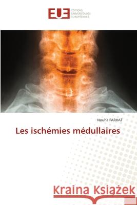 Les isch?mies m?dullaires Nouha Farhat 9786206717218 Editions Universitaires Europeennes - książka